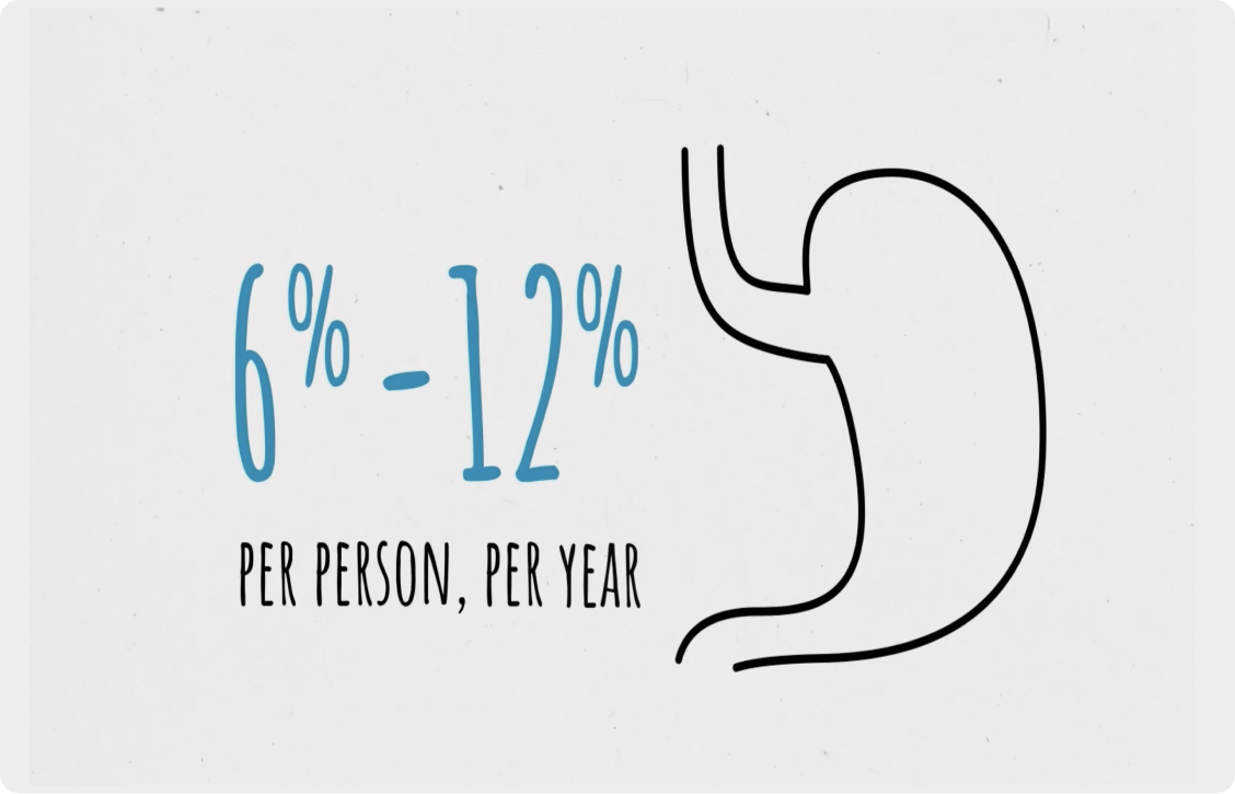 How Often Does Barrett's Esophagus Turn To Cancer Barrett's Esophagus Cancer Risk | Castle Biosciences